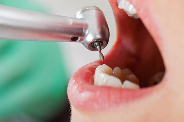 Best After-Hours Dental Trauma Care in Doffing, TX